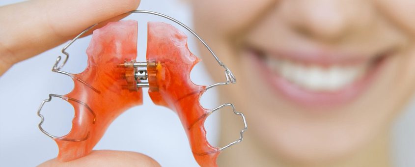 img-orthodontic-retention Clear orthodontic retainer or aligner held up to light, showing red dental model with person smiling in background.