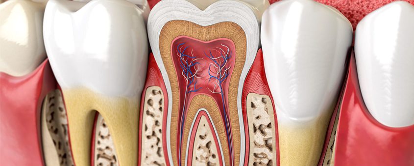 Dental cross-section diagram showing tooth anatomy with pulp, dentin, enamel, and root structure.