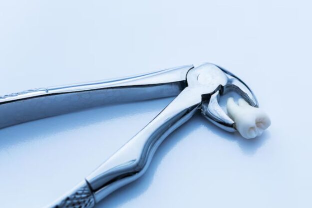 Tips for proper aftercare after wisdom teeth removal, including do's and don'ts