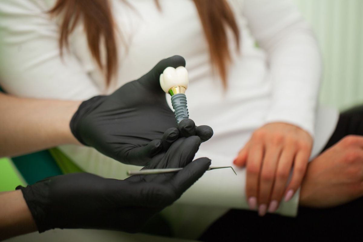 Dental implant types explained by a dentist Dental implant types and options explained by a professional dentist.