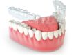 Clean Invisalign aligner model.
