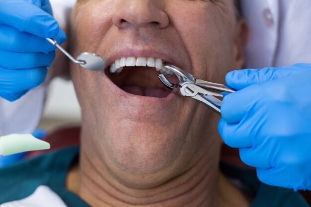 Dentist performing tooth extraction procedure on a male patient.
