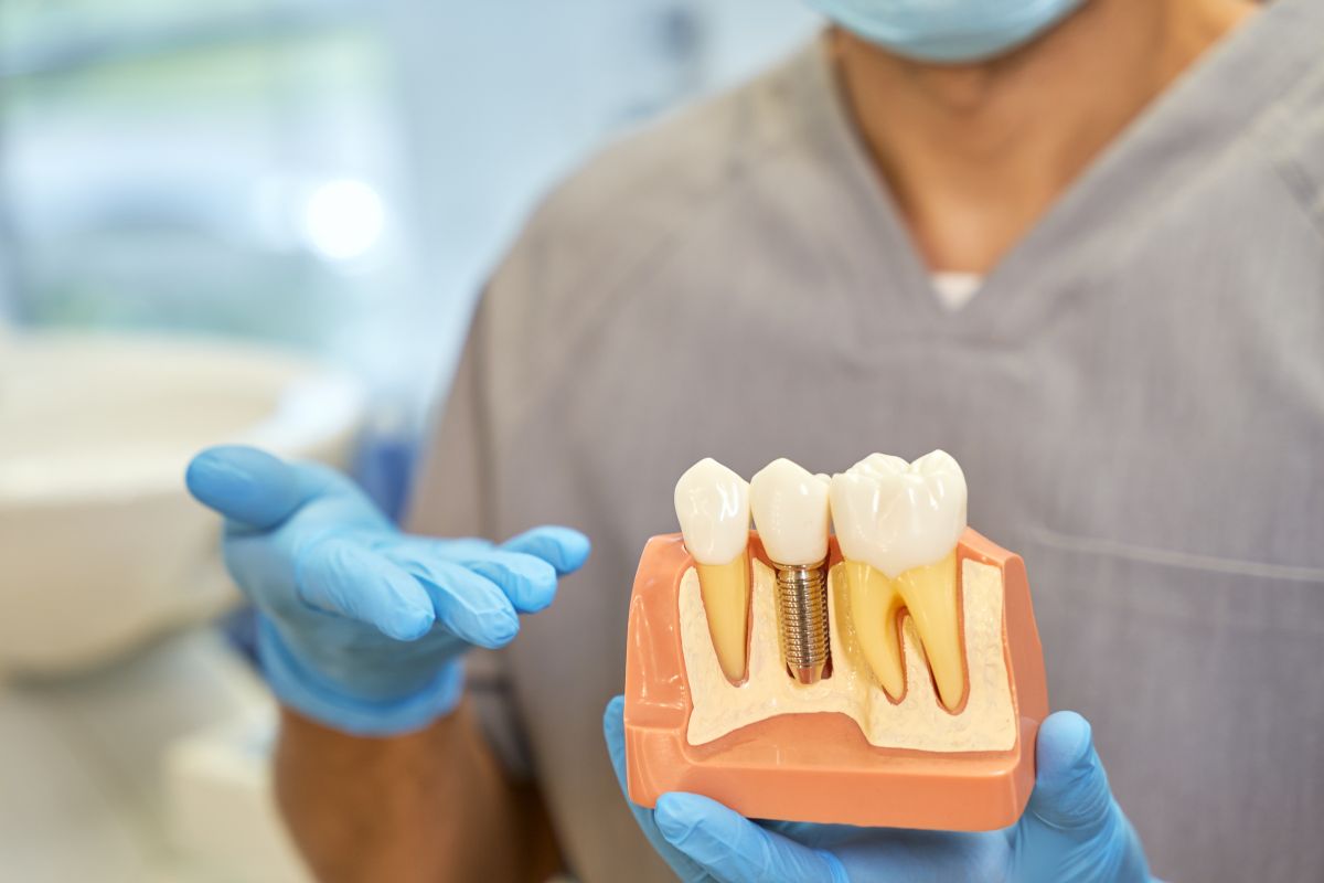 A dentist holding a dental implant model showing tooth structure and implant placement.