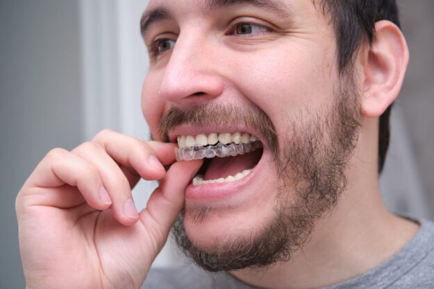 A man placing an Invisalign aligner onto his teeth.