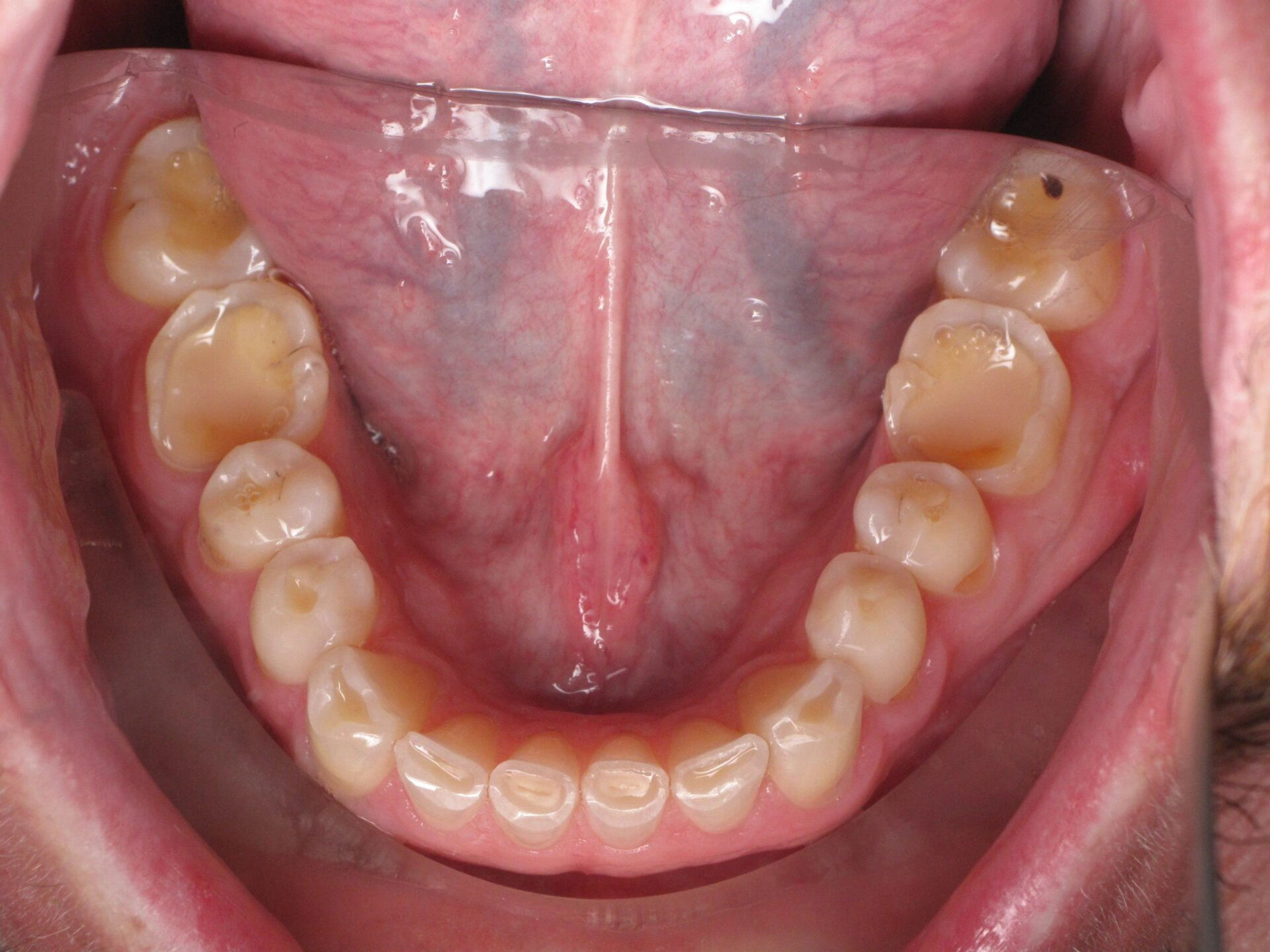 Before Patient 4