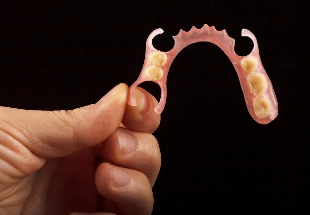 Filling the Gaps Between Your Teeth