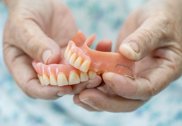 Removable Dentures: A Simple Solution for a Complete Smile