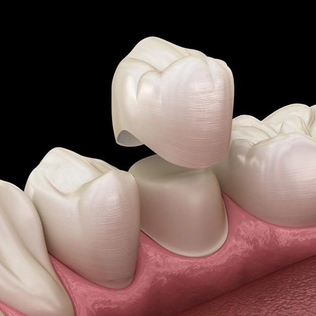 Bring Back Strength and Function to Your Smile