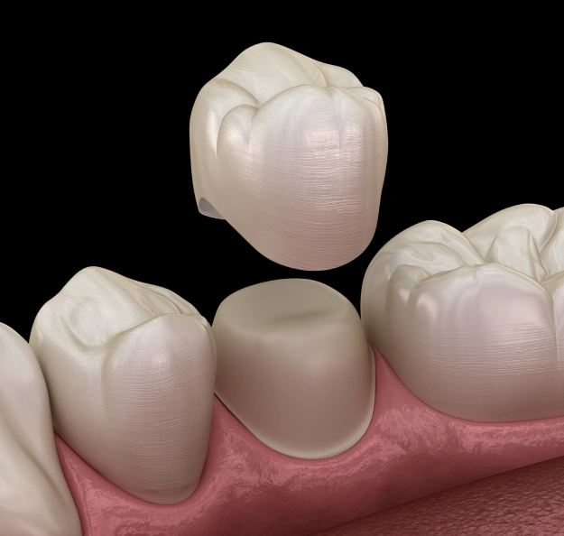 Restoring Strength and Function to Your Teeth