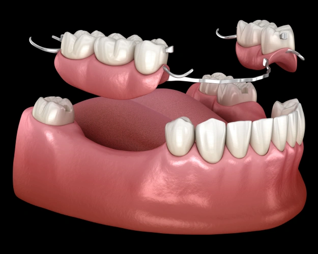 Prosthodontic Solutions for Stronger, Healthier Smiles